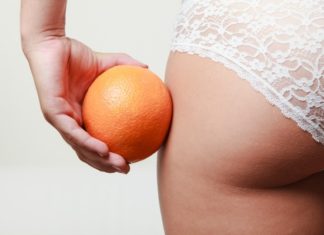 How to Get Rid of Cellulite: 10 Natural Remedies That Work
