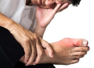7 Gout Remedies to Prevent and Relieve Pain Quickly