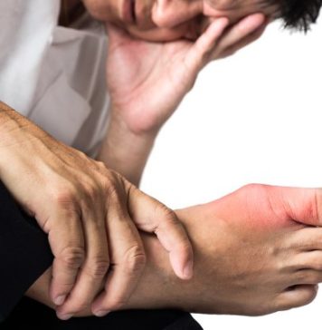 7 Gout Remedies to Prevent and Relieve Pain Quickly